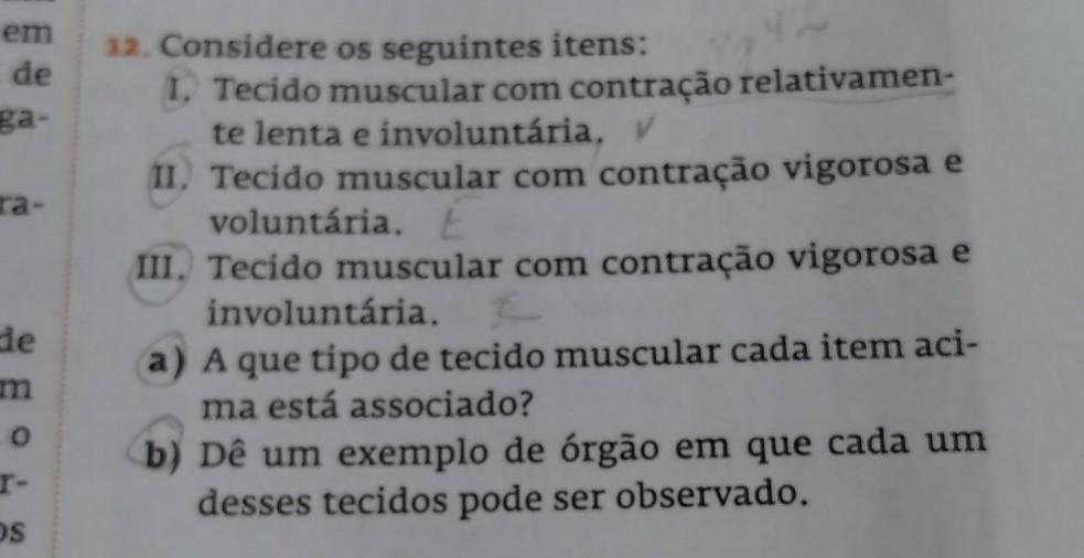 b) de um exemplo de órgão em que cada um desses tecidos pode ser observados